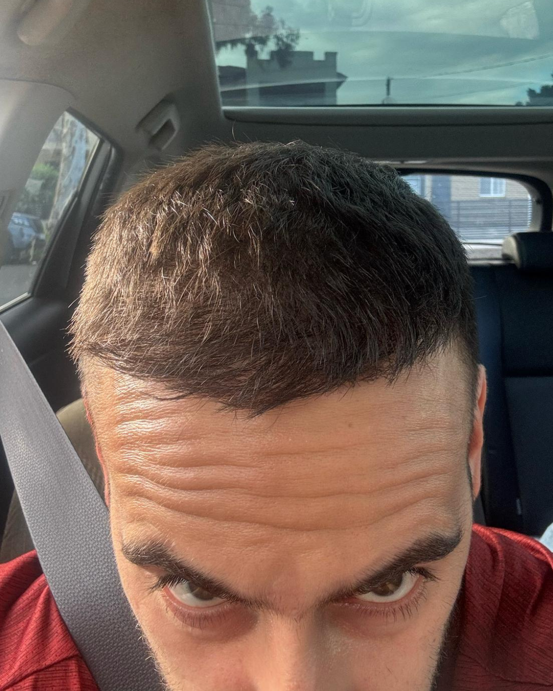 after-10