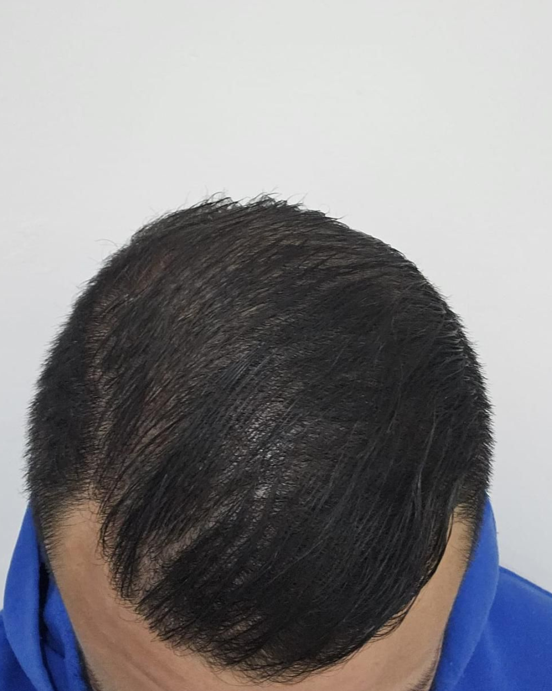 after-3