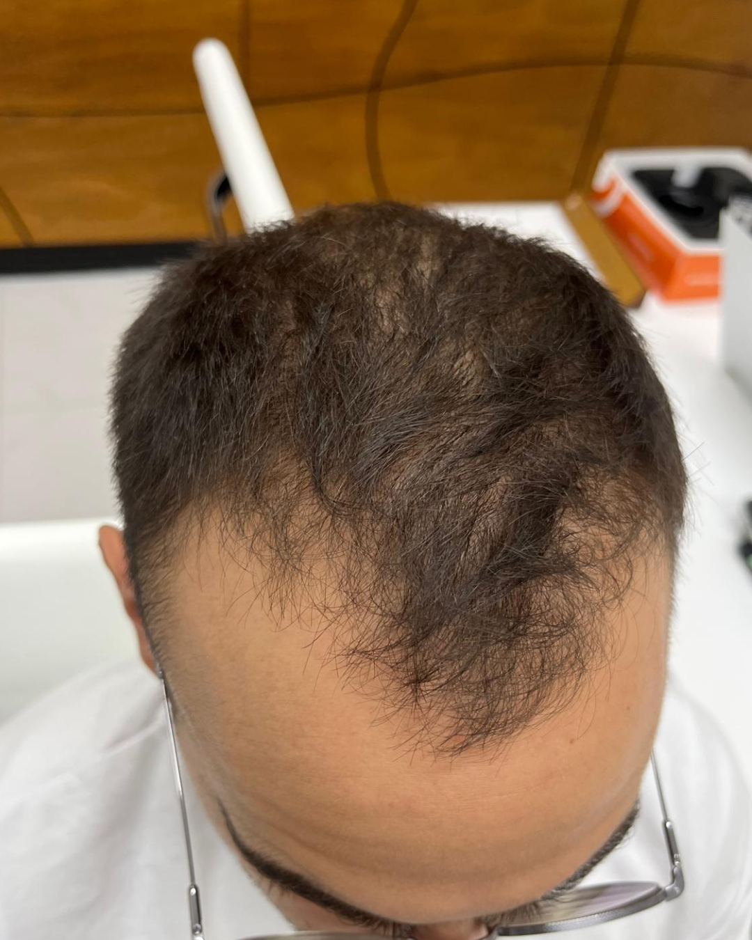 before-10