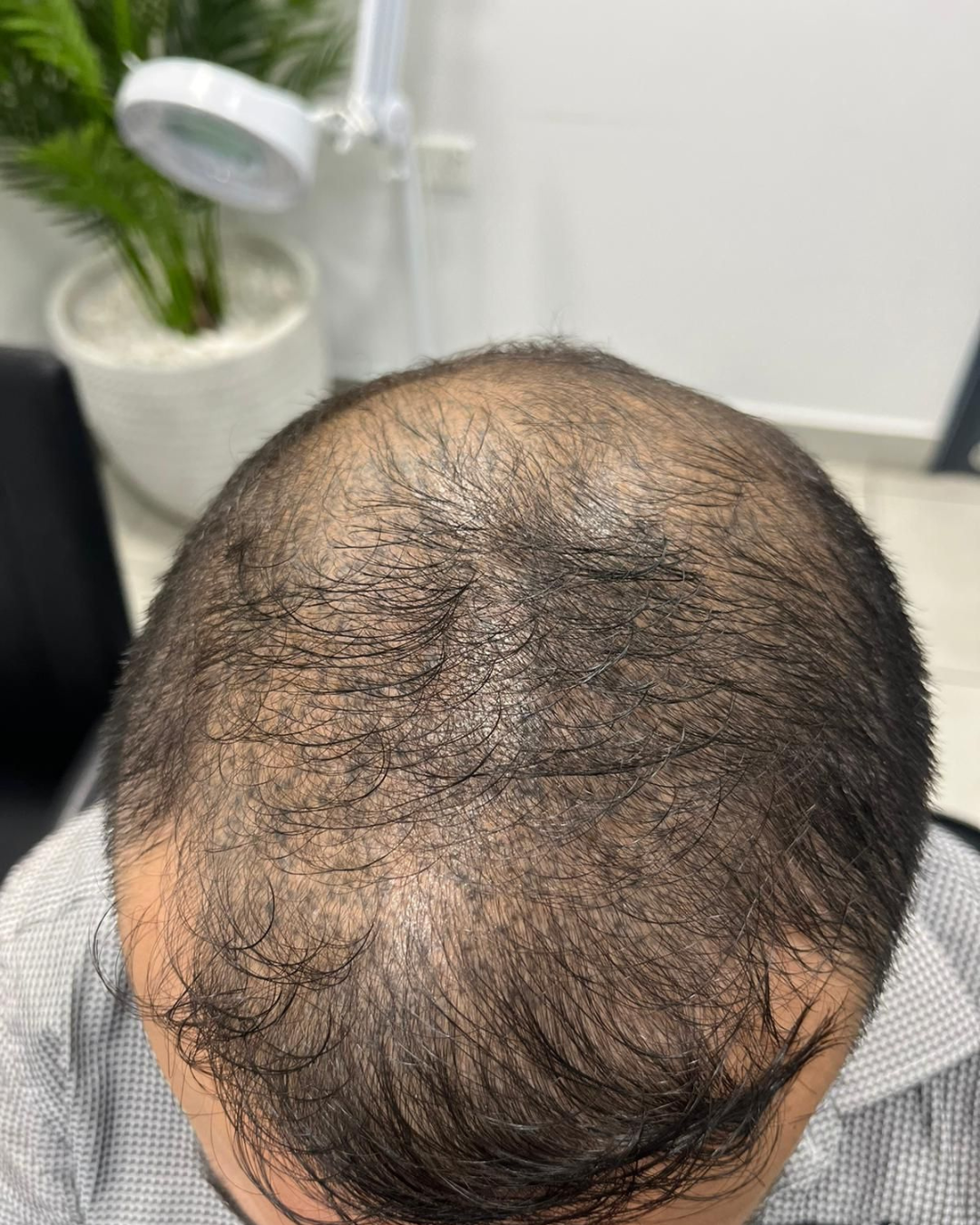 before-3
