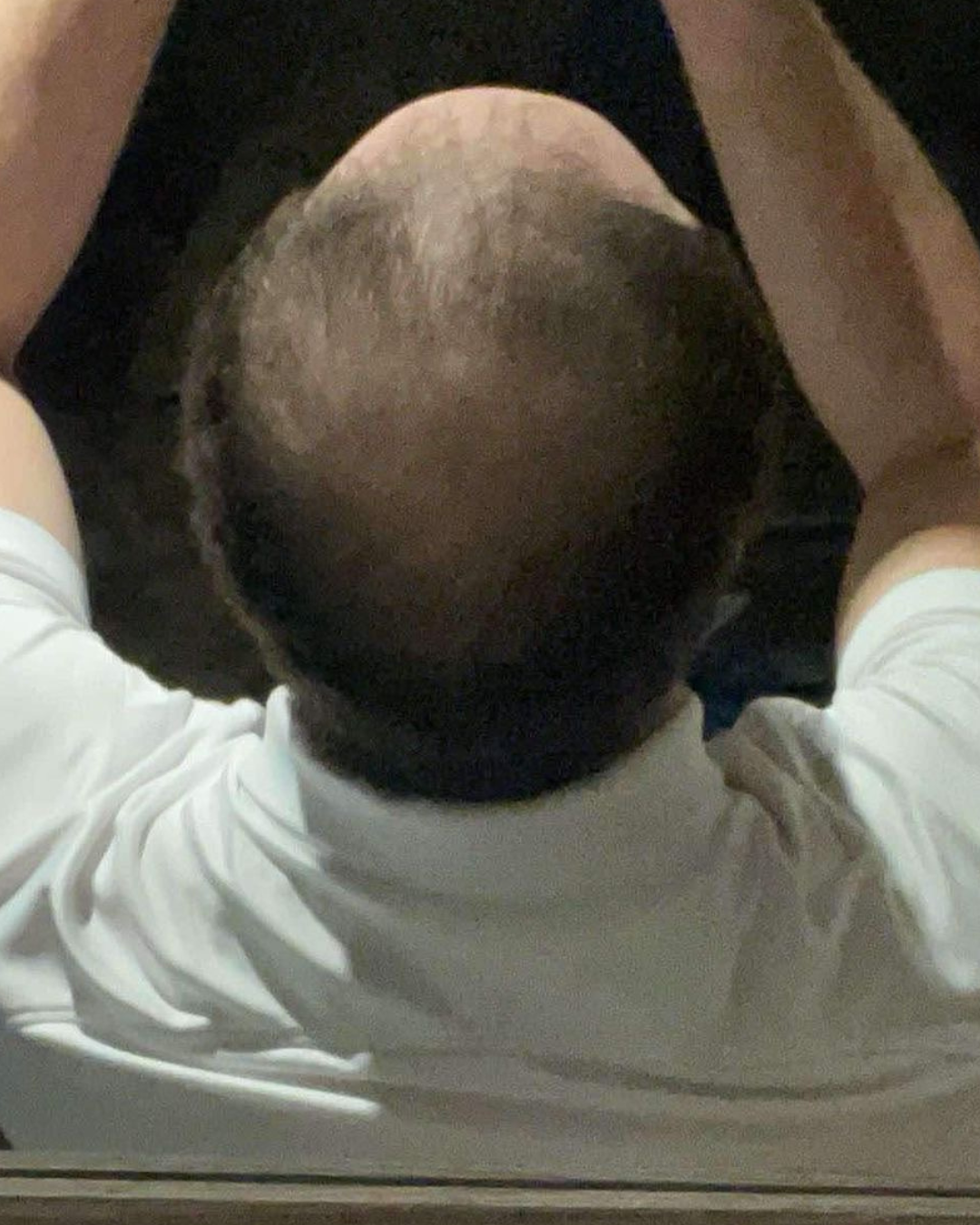 before -4