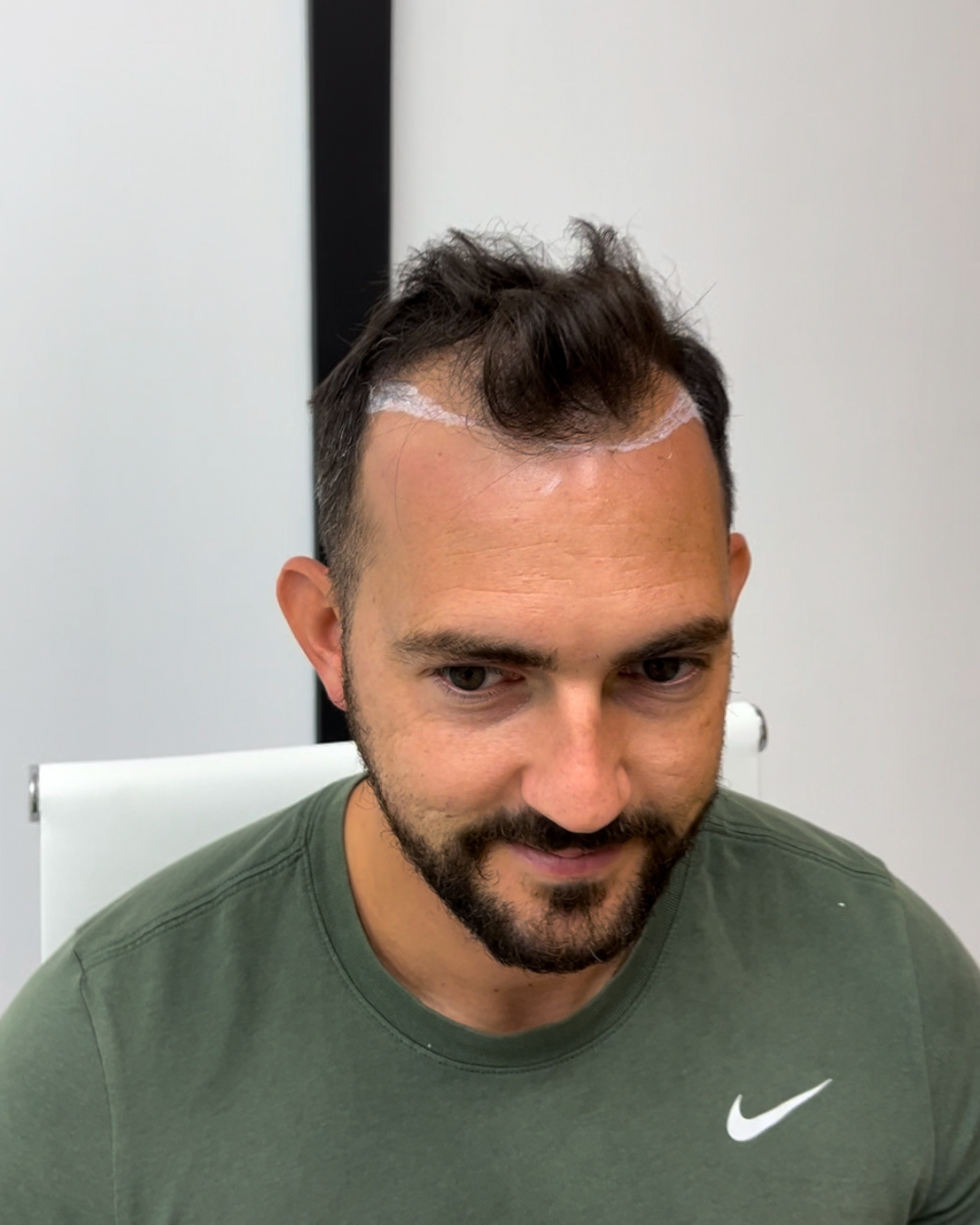 before-5