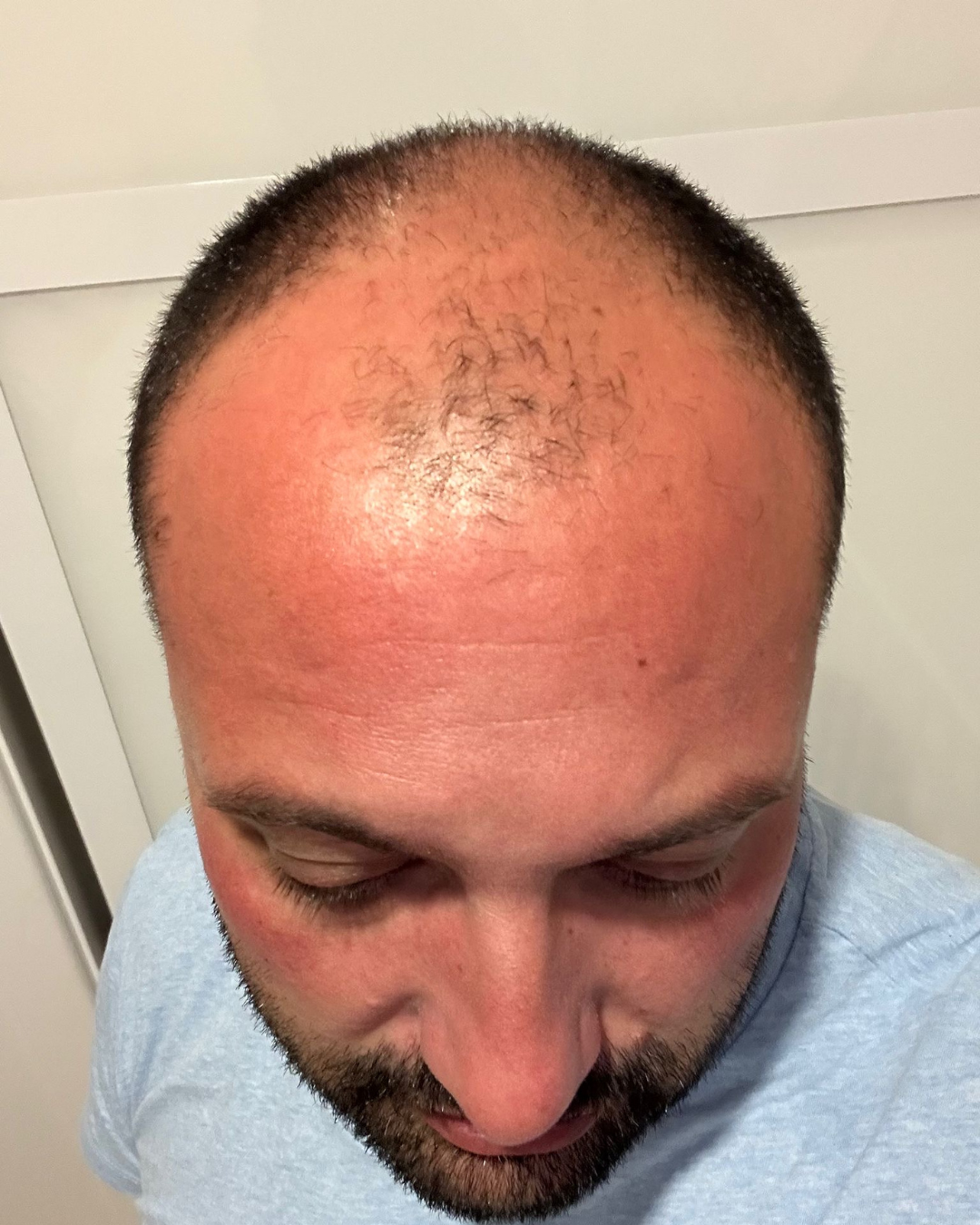 before-8