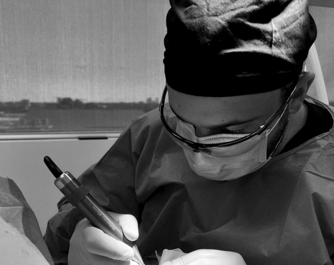 Step-by-Step: Your Hair Transplant Journey