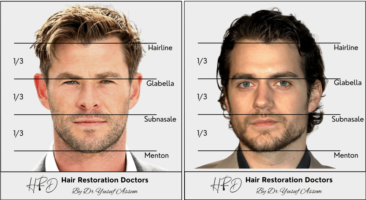The Art of Hair Transplant Surgery